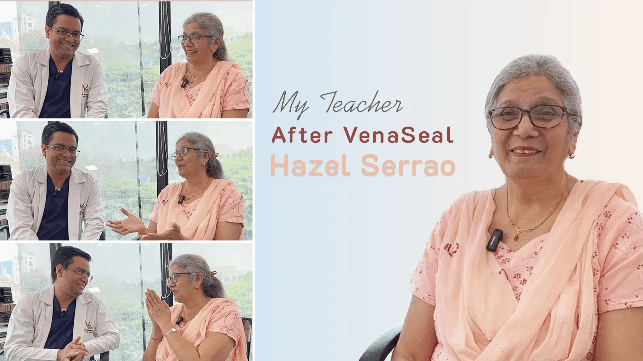 Hazel Serrao VenaSeal Patient Review at The Vein Center Mumbai