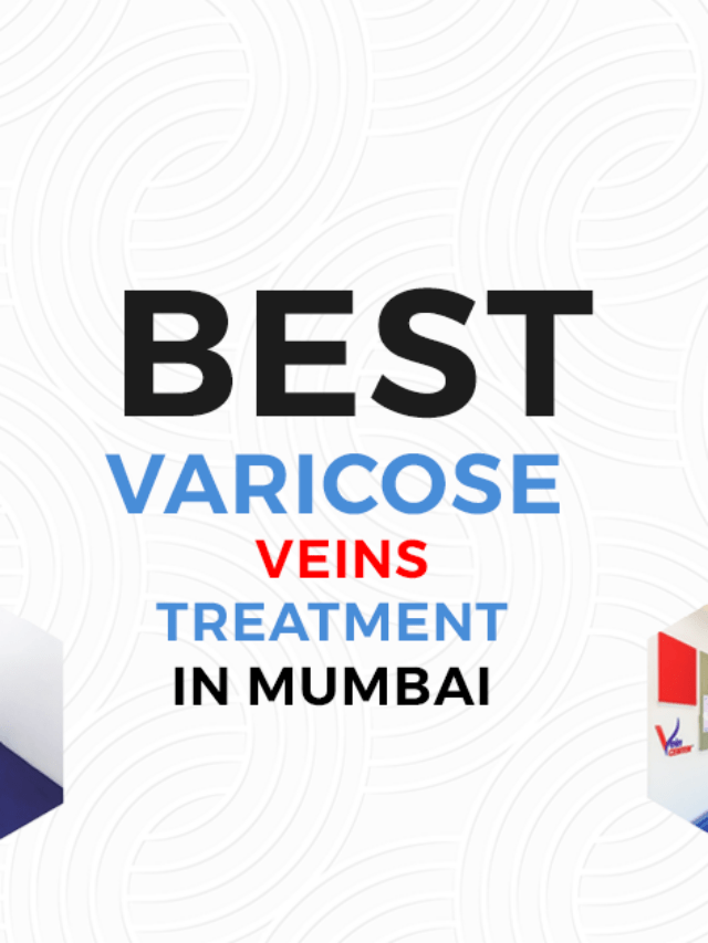 Best Varicose Veins Treatment in Mumbai